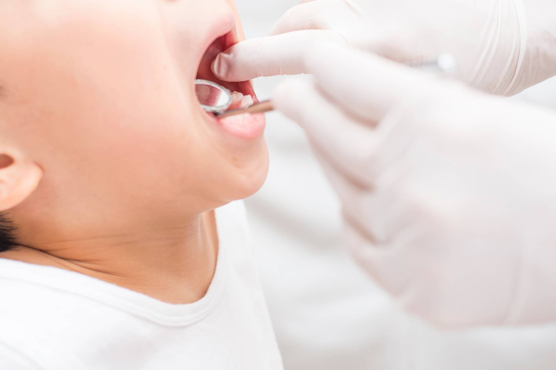 ①むし歯ゼロの鍵は「3歳まで」